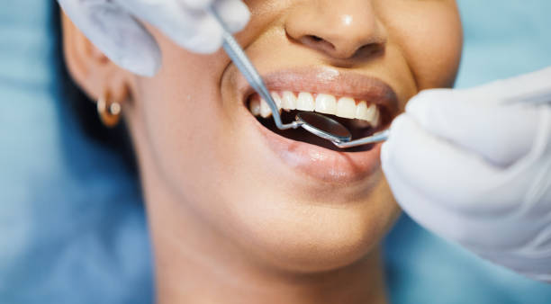 Best Emergency Tooth Extraction in Panama City Beach, FL